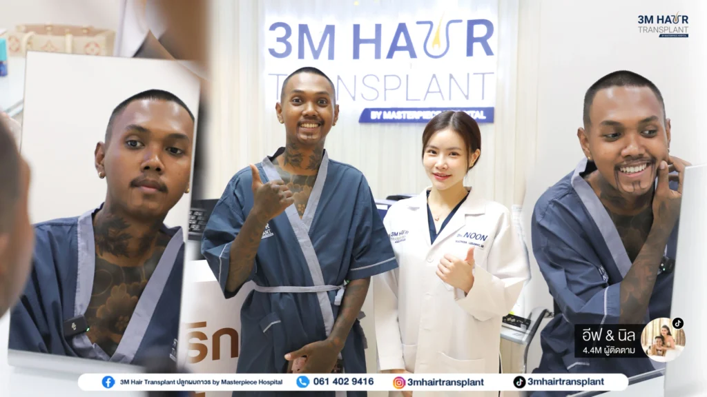 3M Hair Transplant โรงพยาบาลมาสเตอร์พีชจะออกแบบโดยเฉพาะเคสต่อเคส