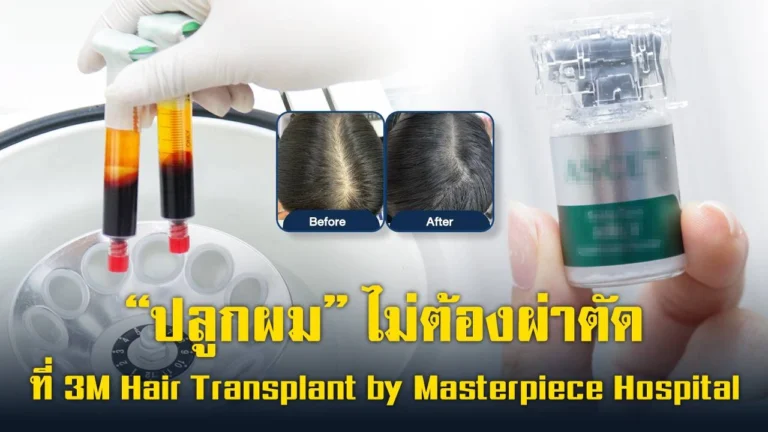 non-surgical-hair-transplant-no-recovery