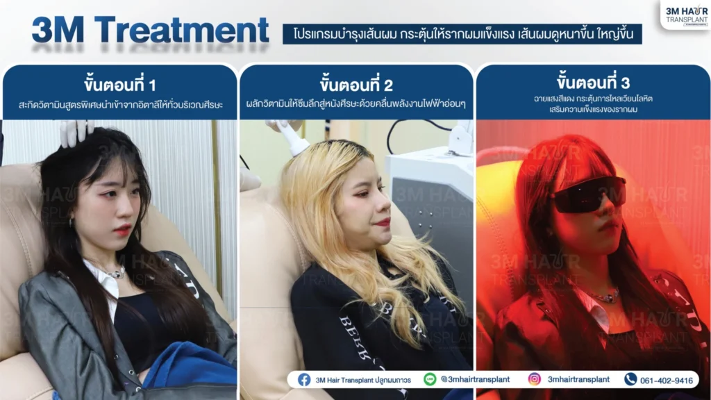 ขั้นตอนการปลูกผมที่ 3m hair