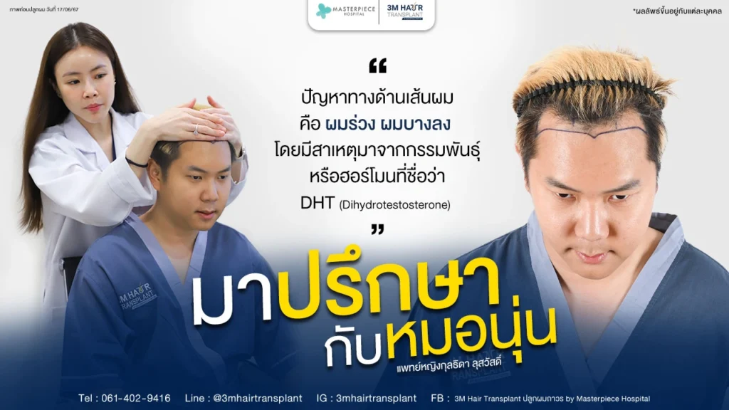 ปรึกษาปัญหาผมบางหัวล้านกับหมอนุ่น