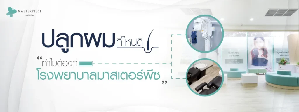 ปลูกผมที่ไหนดี-ทำไมต้องที่โรงพยาบาลมาสเตอร์พีซ-14-02-2566