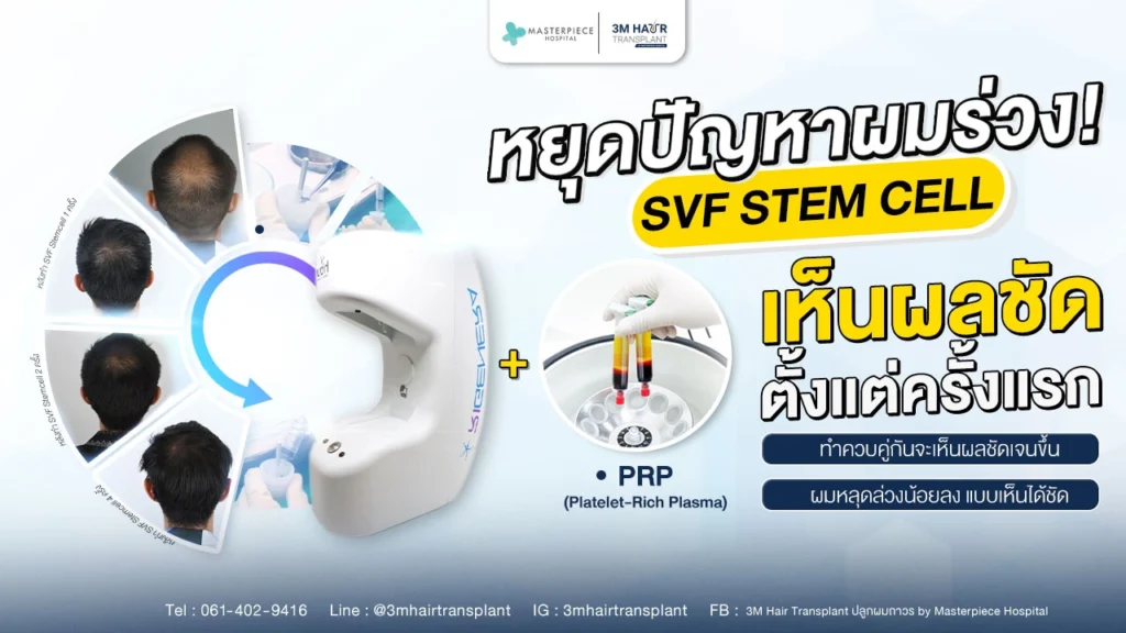 หยุดปัญหาผมร่วง SVF STEM CELL เห็นผลชัดเจน