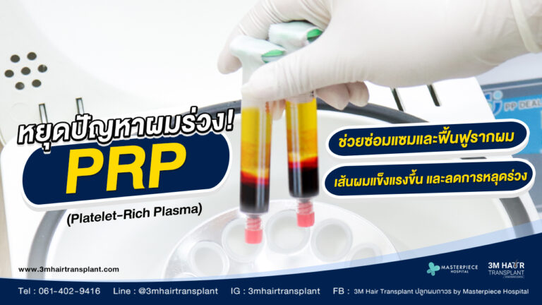 PRP (Platelet-Rich Plasma)