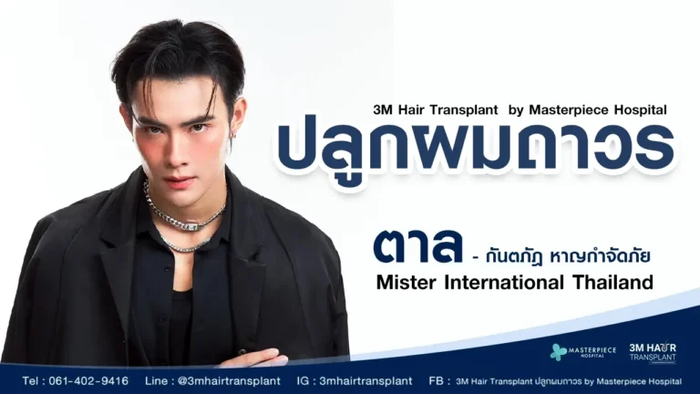 ปัญหาผมบางเกิดจากอะไร และวิธีการปลูกผมจะช่วยแก้ไขได้ไหม?